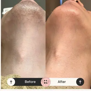 男女兼用脱毛＆ドライ ヘッドスパ トレテルのエステ・リラクイメージ