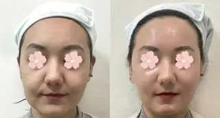 パーマ aliaハイフ&水光ジェットサロン所属・aliaハーブ水光店 エステティシャン募集のエステ・リラクイメージ