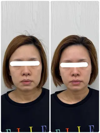 美容鍼×小顔矯正 ×美容整体　浜川泰仁のエステ・リラクイメージ