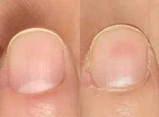 ネイル 自爪育成・ネイルケア エルメのネイルデザイン