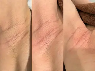 EstheticSalonReTweet所属・竹谷 春希のエステ・リラクイメージ