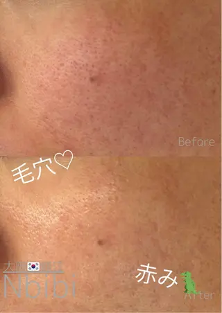 韓国🇰🇷価格 サロン_Nbibiのエステ・リラクイメージ