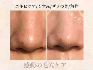 ハイフ・小顔・骨盤 シャングリラのエステ・リラクイメージ