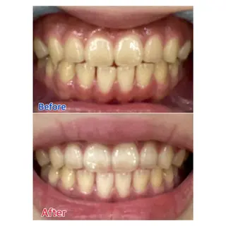 MBEAUTYSALON 千葉店・京成大久保所属・Melty 輝のその他イメージ