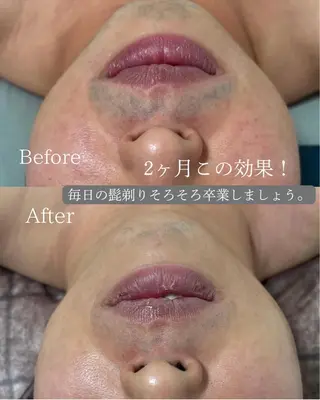 Libra所属・Libra 脱毛/ホワイトニングのその他イメージ