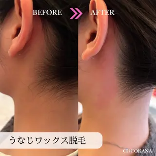 脱毛サロン COCOKANA所属・脱毛サロン COCOKANAの眉毛・アイブロウイメージ