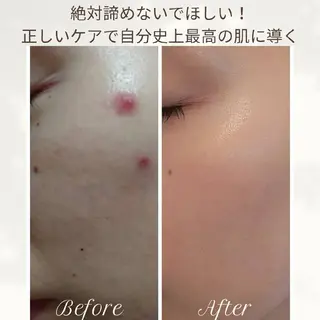 Glossy salonのエステ・リラクイメージ