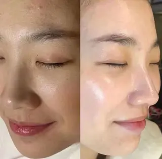 ネイル aliaハイフ&水光ジェットサロン所属・aliaハーブ水光店 エステティシャン募集のエステ・リラクイメージ