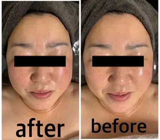 食べながら魅せボディ éclatJua川越のエステ・リラクイメージ