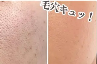 美BELLO 池袋のエステ・リラクイメージ