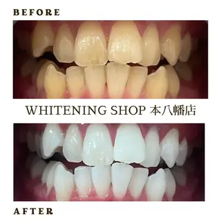 メンズ ホワイトニング ショップ本八幡店のエステ・リラクイメージ