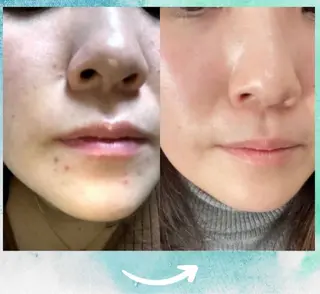 エステ♡Eden Asamiのエステ・リラクイメージ