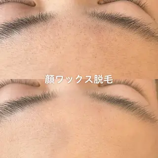 EST BEAUTY所属・顔ワックス脱毛/ ハーブピーリングのエステ・リラクイメージ