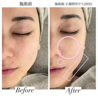 【Salon D】 HALUのエステ・リラクイメージ