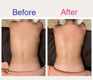 Rewhite -ﾘﾎﾜｲﾄ-のエステ・リラクイメージ