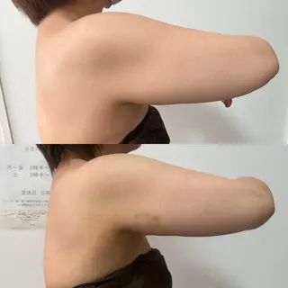 Miiju.所属・石巻 冷却痩身 Miiju. 鈴木のエステ・リラクイメージ