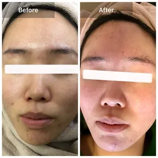 ハーブピーリング 専門店MOKA所属・ハーブピーリング専門 MOKAのエステ・リラクイメージ