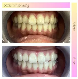 セルフホワイトニングサロンエクシアホワイト倉敷店所属・ecxiawhite 倉敷店のエステ・リラクイメージ