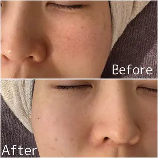 MiEL  total beaty salon所属・肌質改善サロン ナツコのエステ・リラクイメージ