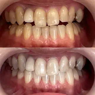 ホワイトニングサロンライエ所属・岡本 由香理のその他イメージ