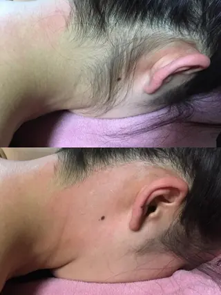 Puni 〜プーニー〜のエステ・リラクイメージ