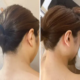 うなじ脱毛/美肌脱毛 LABELのエステ・リラクイメージ