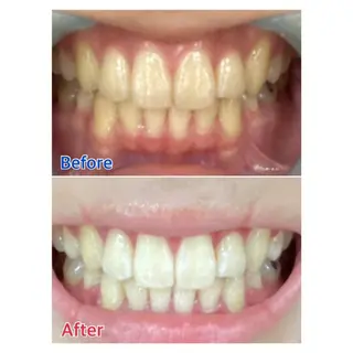 MBEAUTYSALON 千葉店・京成大久保所属・Melty 輝のその他イメージ