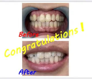 セルフホワイトニングサロン　ラヴィアン所属・ホワイトニングサロン La vie enのその他イメージ