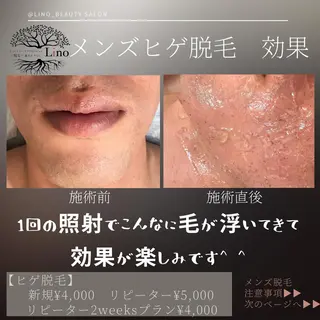 メンズ キッズ ネイル マツエク・マツパ Lino 《リノ》のエステ・リラクイメージ