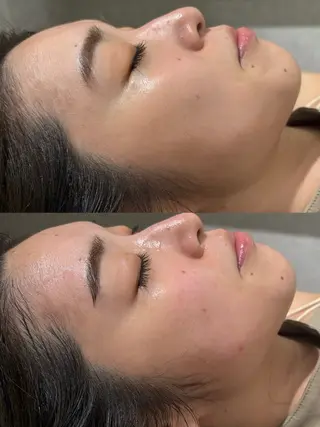 美容鍼灸サロン mahoroba院長のエステ・リラクイメージ