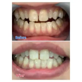 M渋谷店所属・M渋谷 ホワイトニングのエステ・リラクイメージ