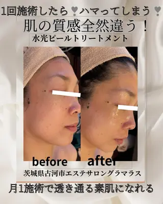 エステサロン グラマラスのエステ・リラクイメージ