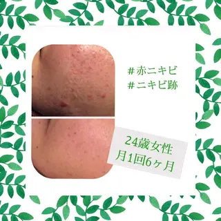 ミディアム カラー パーマ ヘアアレンジ メンズ キッズ ネイル マツエク・マツパ ニキビ・肌質改善専門 ♡人生が変わるサロンのエステ・リラクイメージ