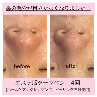 leolo武蔵浦和 肌質改善＆脱毛のエステ・リラクイメージ