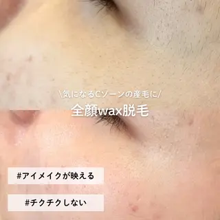 EST BEAUTY所属・顔ワックス脱毛/ ハーブピーリングのエステ・リラクイメージ