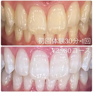 PLATINUM Beauty 横浜店所属・ホワイトニングルーム 横浜店のその他イメージ