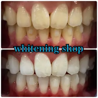 ホワイトニング ショップ千葉店のその他イメージ