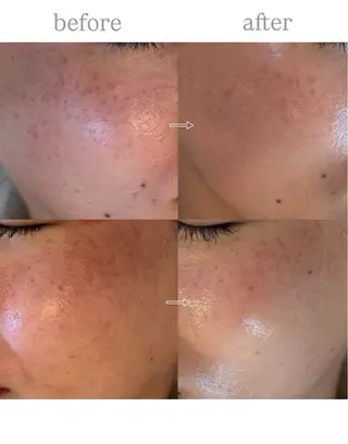 anthes /MIHOのエステ・リラクイメージ