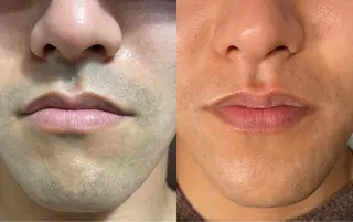 メンズ mimi 広島 安佐南区まつ毛･脱毛のマツエク・マツパデザイン