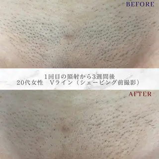 トータルビューティー サロン　Lisseの眉毛・アイブロウイメージ