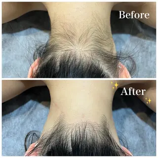 脱毛サロン fam.豊澤柚良のエステ・リラクイメージ