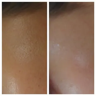 🅖🅤🅩🅔🅛 salonのエステ・リラクイメージ