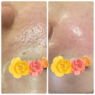 REVITA所属・🆕ハーブピーリング 肌育成のリヴィタのエステ・リラクイメージ