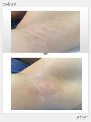 肌改善専門 浦和美園のエステ・リラクイメージ