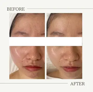 肌育成サロン ♡ RISAのエステ・リラクイメージ