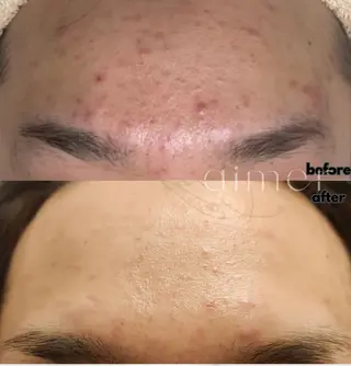 aimer 栄店のエステ・リラクイメージ