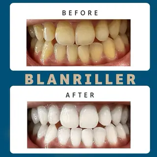 BLANRILLER所属・ホワイトニングサロン ブランリエ阿倍野店のその他イメージ