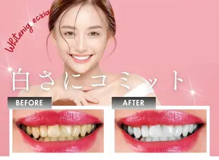 セルフホワイトニング エクシア徳島店のその他イメージ