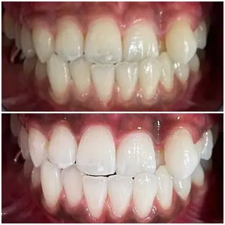 五十嵐 蓮のその他イメージ