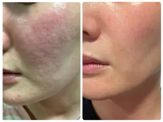 Luce所属・Luce Shokoのエステ・リラクイメージ